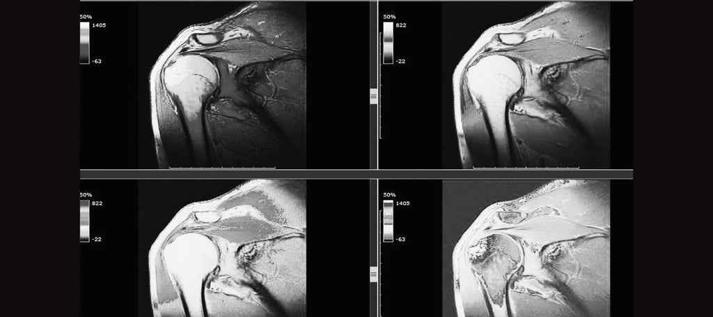 Does Your Whole Body Go In For A Shoulder Mri